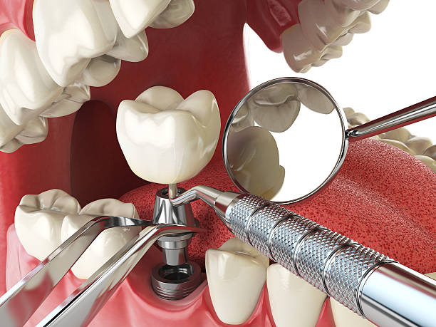 Best Emergency Dental Services for Seniors in West Kittanning, PA